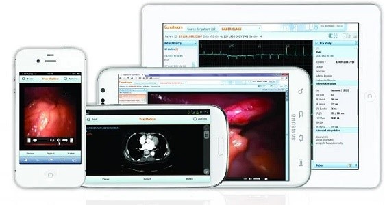 مشکلات استفاده از فیلم رادیولوژی چیست؟ مشکلات استفاده از فیلم رادیولوژی چیست؟